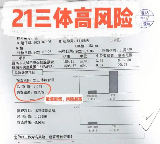 我的唐筛21三体高风险羊水穿刺翻盘78