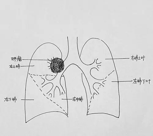 许林教授手绘解剖图