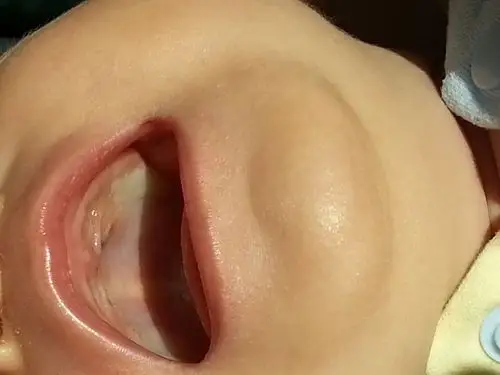 吃母乳,喝水,冲奶粉也不行,一会一哭,体温,面色都正常,仔细看了口腔