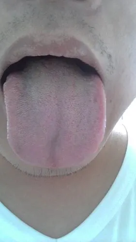 分享到:  2012-05-02 19:02  提问者采纳 脾虚湿盛,可健脾燥湿祛痰.