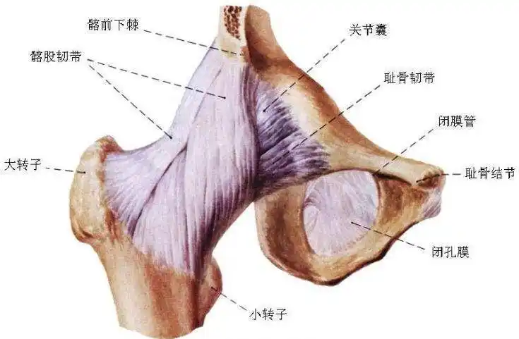 关节边缘囊性改变或髋臼外缘和股骨头边缘骨质增生(韧带骨赘形成)