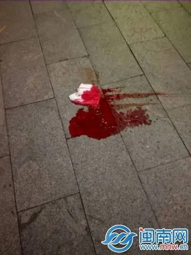 九一街口一老人摔倒在地 脑后鲜血直流