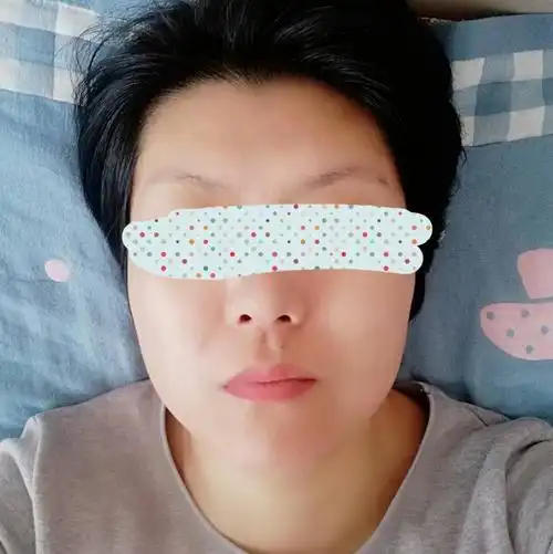 额头低窄平不饱满,脸型大,宽留不了长头发很难看丑死了,能丰额头吗?