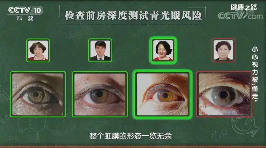 测试三:视野测试青光眼会影响视野,视野是青光眼判断和随诊的重要指标