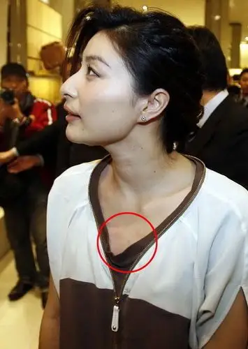 郭晶晶潮人装走穴 胸前现红斑再惹"吻痕"疑云