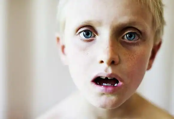 弱智儿童能得到治疗吗?孩子是家庭的希望.