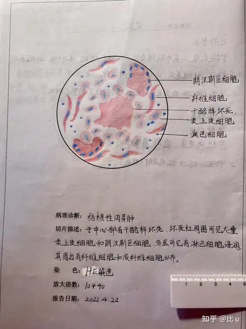 病理学 实验绘图(红蓝铅笔) - 知乎