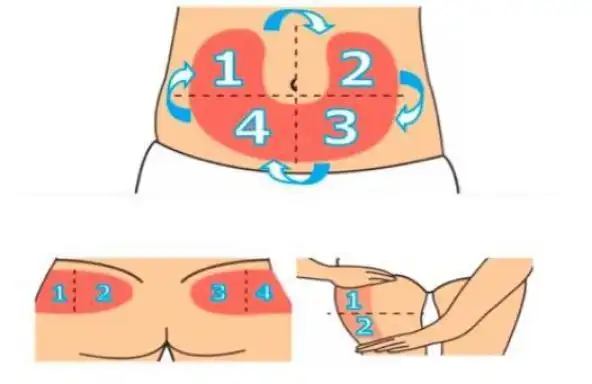 在大腿上注射时,只能在大腿前面或外侧面进行注射,因为大腿内侧有较多