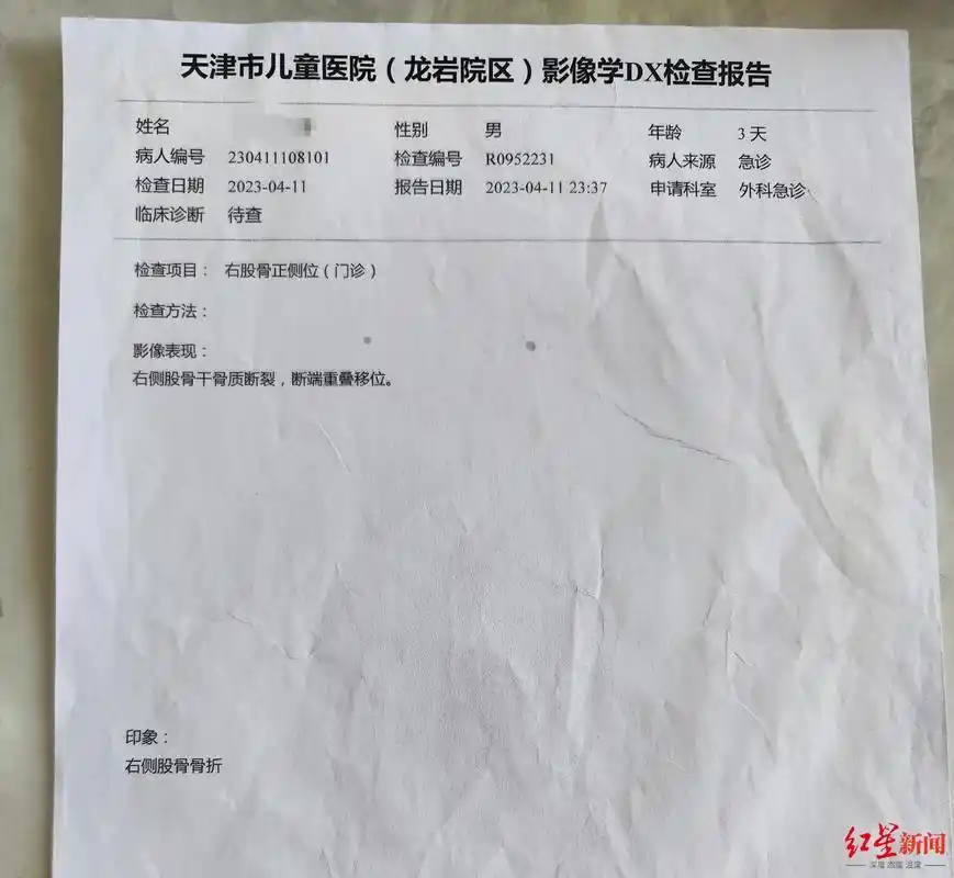 67剖宫产时孩子大腿被主刀医生掰骨折院方医生已停职