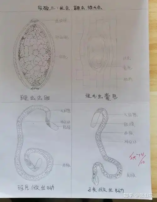 蛔虫图片删了怪可惜的,记录一下自己的寄生虫画图吧.张山花