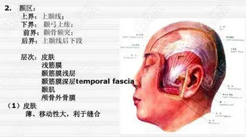 颧弓内推手术前先搞清楚骨膜提升和筋膜提升相同吗