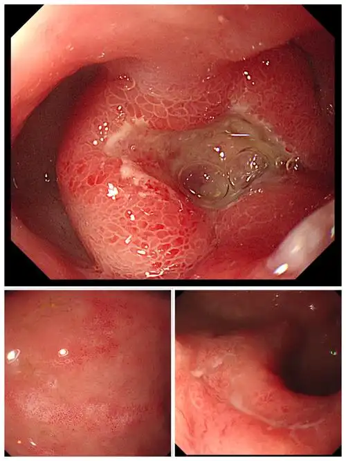 您的胃由开源医院守护