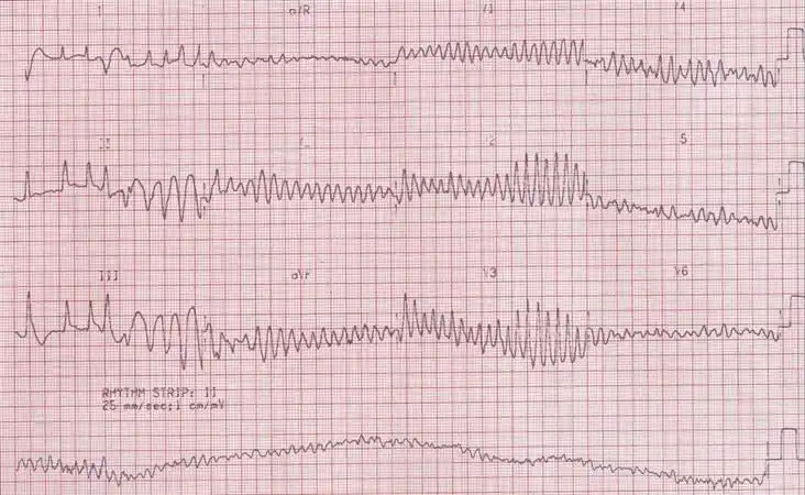 身边有人心跳骤停,我该怎么办?_心脏