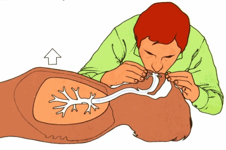 做人工呼吸须具备的条件