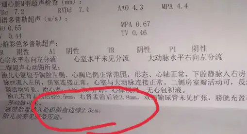 孕晚期,若b超单上经常出现这"5个字"家里可能要添""