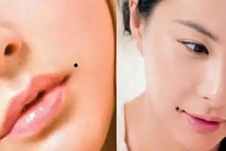【图】女人右嘴角上方有痣好不好 关系到命运的知识