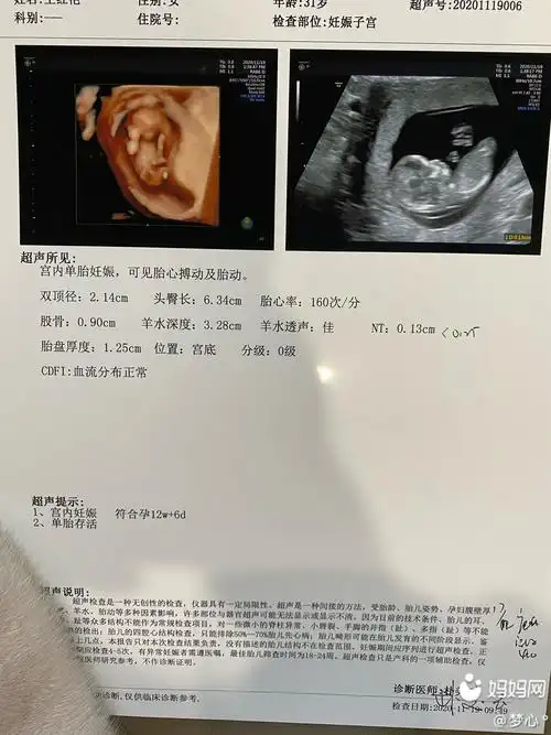 孕12周 2天延边朝鲜族自治州2020年11月 男宝54% 女宝46%