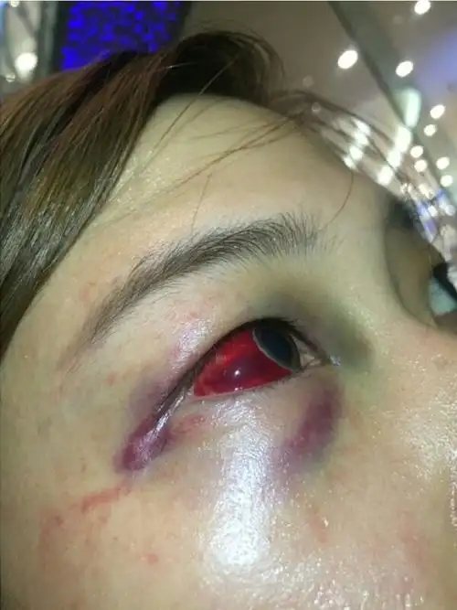 深圳女子称报案被警察围殴 警方称约束醒酒