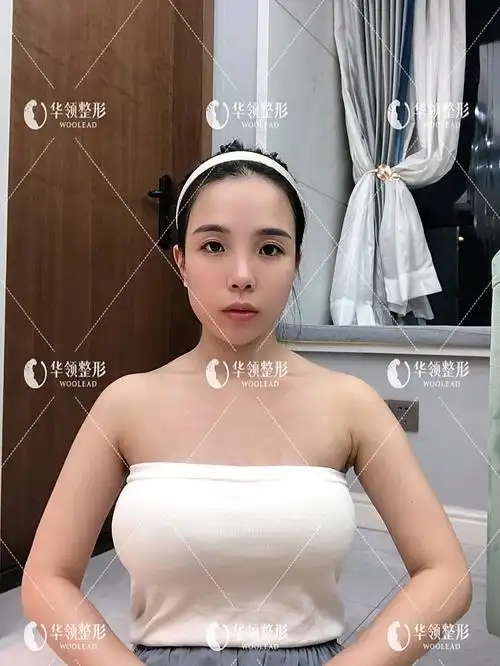 胸部手术术后3天