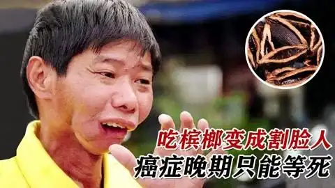 湖南人吃槟榔30年致癌,为了保命只能切掉舌头变割脸人,纪录片