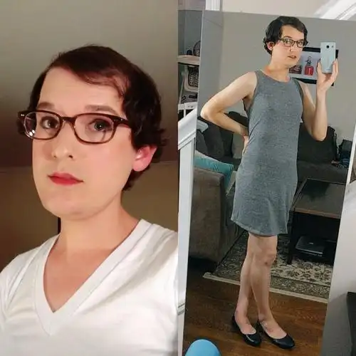 亮瞎眼!男子服用雌激素一年 抠脚大汉变娇娘