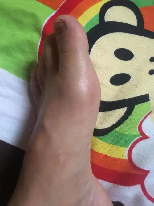 我们这乡医生说脚是痛风.这是我验血报告.看看是不是痛风.