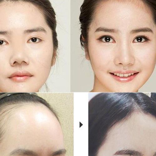 草本脸部丰盈精油太阳穴填充额头苹果肌平法令纹泪沟凹陷v脸塑形