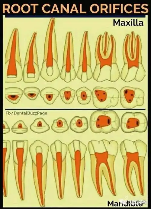 口腔临床进阶——开髓_牙齿
