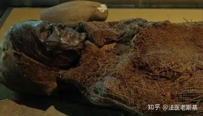 死亡后的身体变化