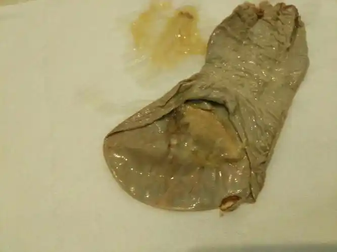 人流20天后突然从下体排出这样一个东西,难怪前段时间总感觉病了一样