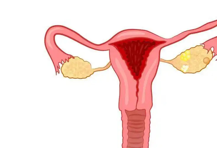 1,经常痛经在子宫发生病变之后身体会有异样,例如经常痛经也是子宫