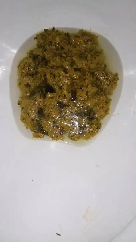 大便每天早上一次,但不成形