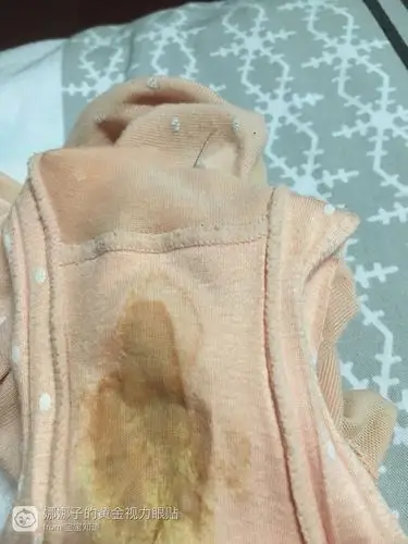 出了两次血了这是怎么回事?直到今天还有点淡淡的血迹