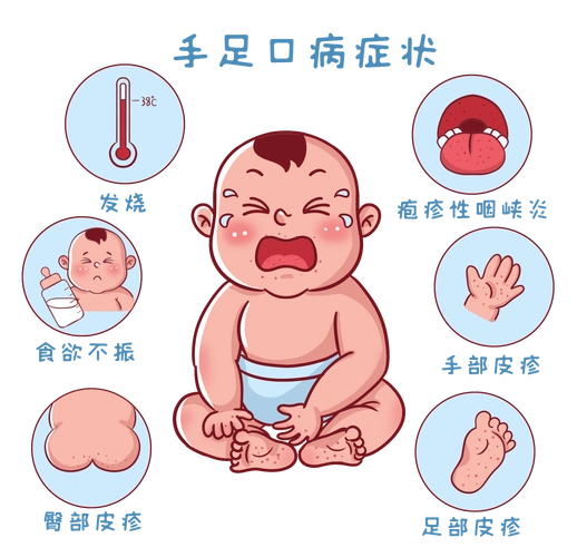 手足口如何识别防控?师生家长要注意