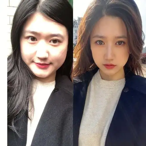 减肥四十斤脸部对比图