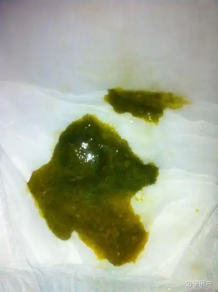 为什么孩子的大便总是绿色的