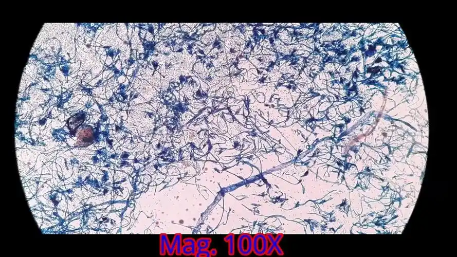 显微镜下的青霉菌