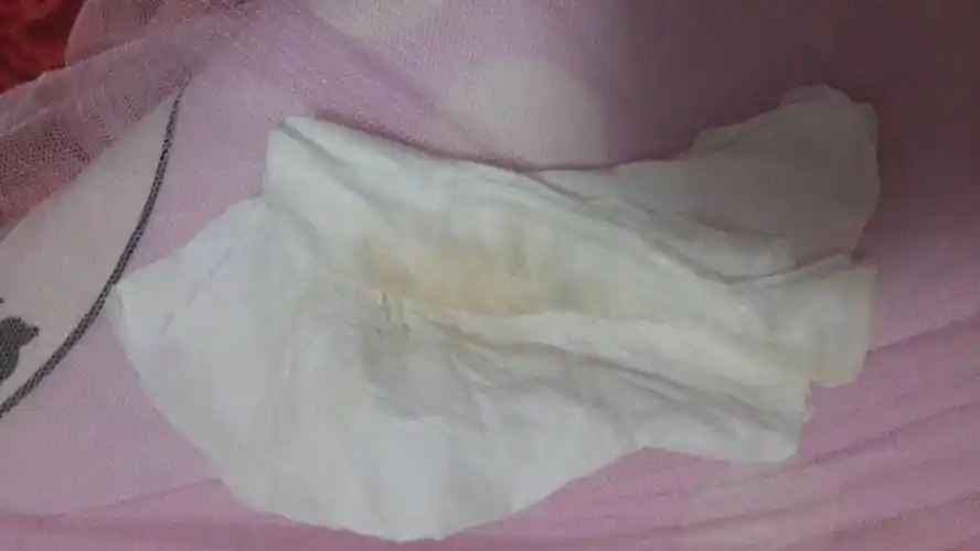 8日排卵的,前几他同房后不大舒服流出这样的东西?是怎么回事?