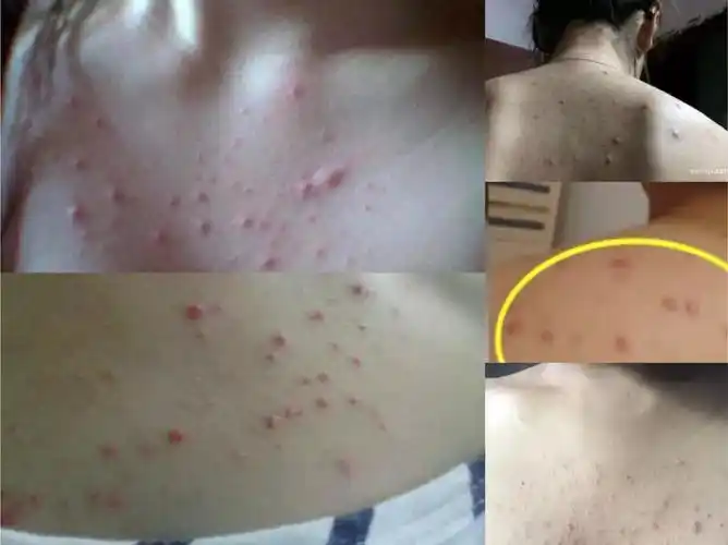 德国变态发明,30秒吸出陈年螨虫,这tm才叫洗干净了!