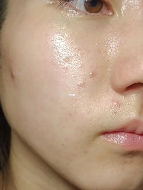 敏感修护|油皮混油选伊蒂凡特安霜_油性皮肤_修复敏感_混油_混油皮