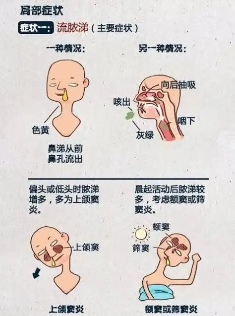 科普节鼻塞流鼻涕可不一定是感冒哟