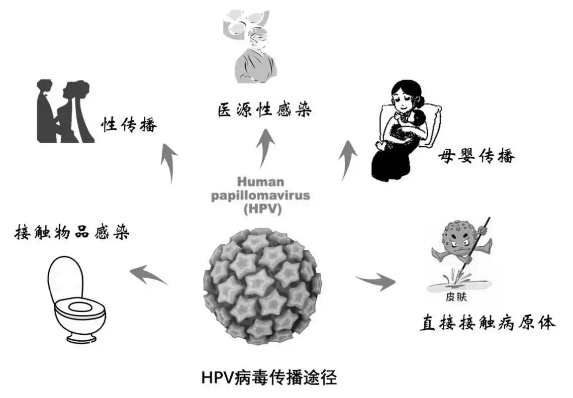 【男性也会感染hpv病毒吗?