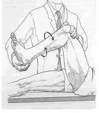 研磨试验需要注意:对急性损伤敏感性高特异性低;对陈旧性损伤,常常