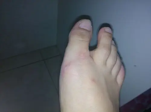 新鞋子脚面磨脚,好疼啊,很喜欢的鞋子,怎么能不磨脚了～ 求各位帮助