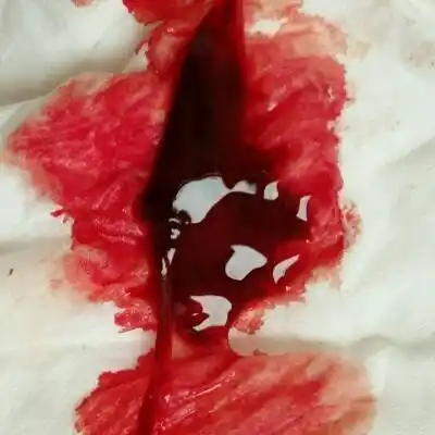 怀孕出血多少是流产了流产出血多长时间