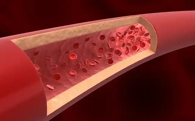血液中的垃圾是什么如何预防血管堵塞