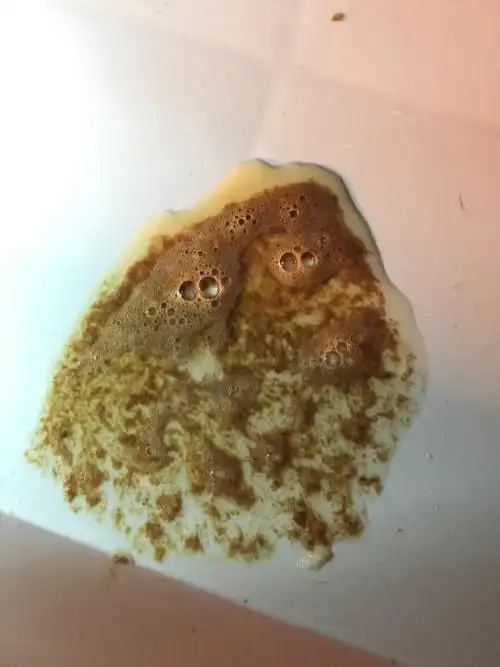 两个月的小狗得了细小病,发现自的算早,输液到第三天已经不吐了,结