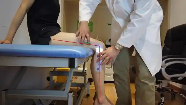 膝关节角度恢复慢可能是角度没量对量角度这样做才准确