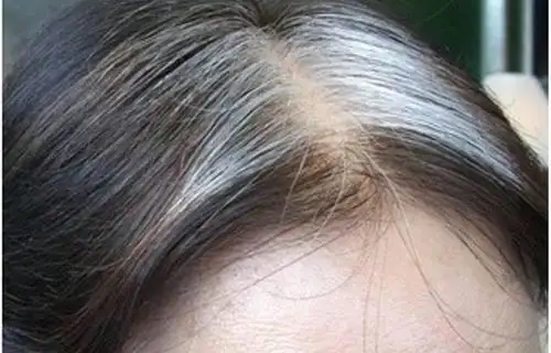 拔一根白头发真的会长十根吗(为什么白头发越拔越多)-飞翔百科