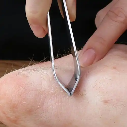 加厚镊子拔毛器夹鸡毛鸭毛夹子夹鱼骨器家用拔猪毛钳厨房用具